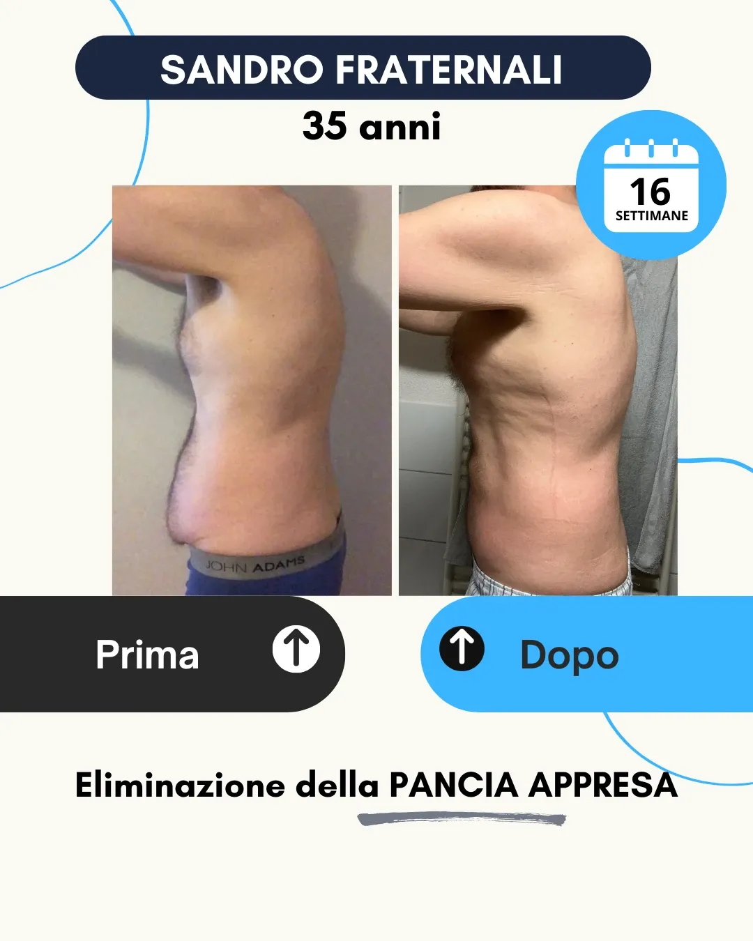 Risultato 45